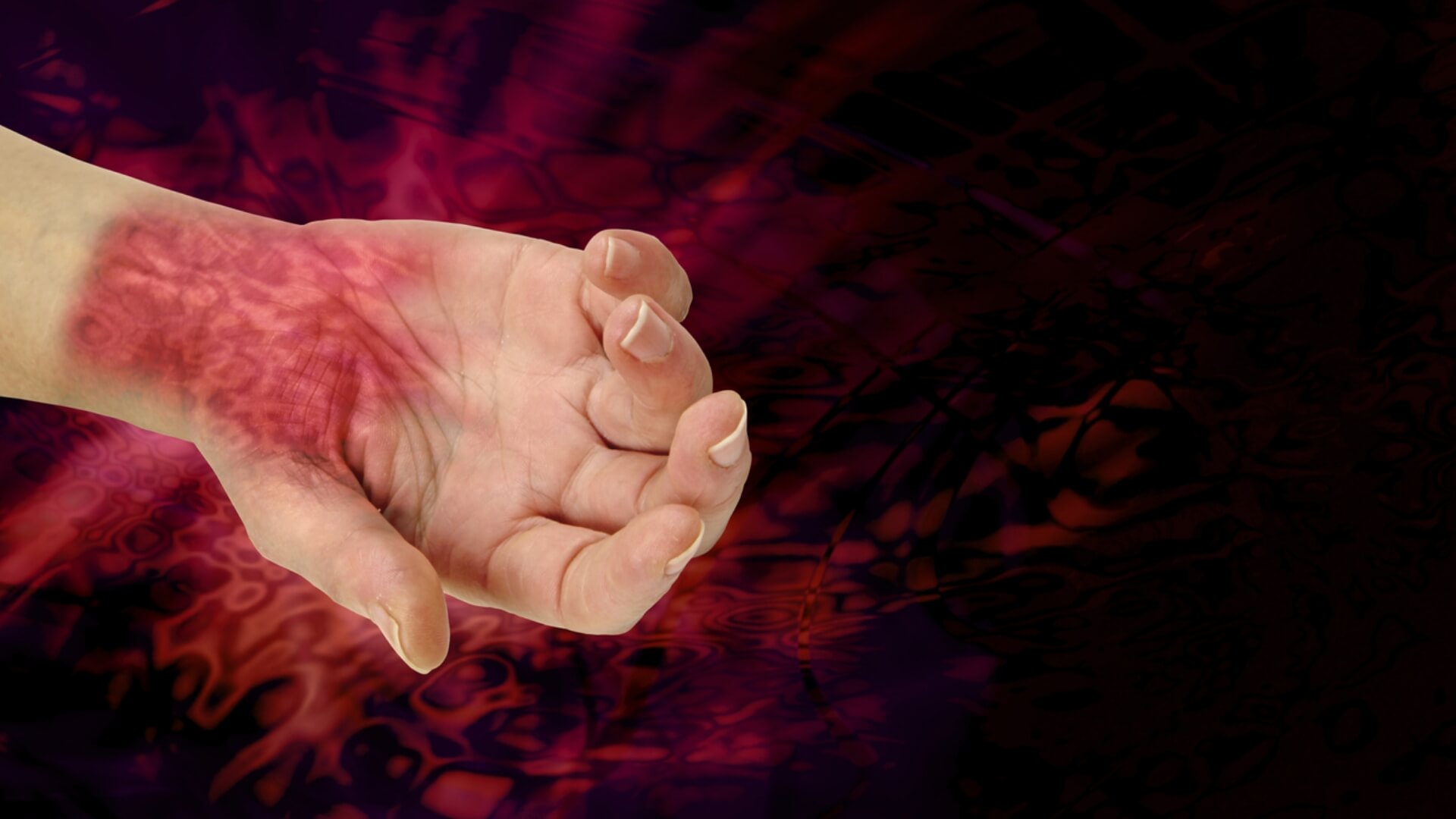 Chemical Burns Guide How to Treat, Prevent, and Stay Safe | CPR1