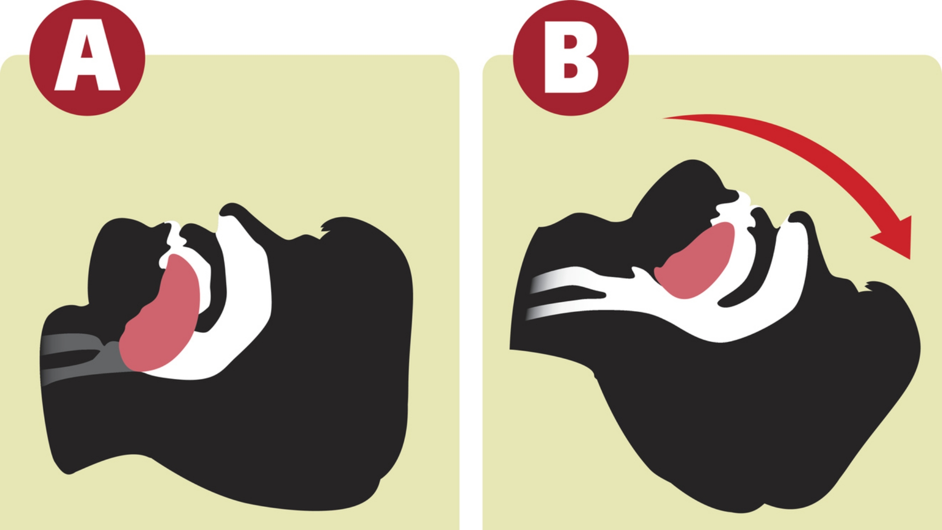 Who invented the Heimlich maneuver