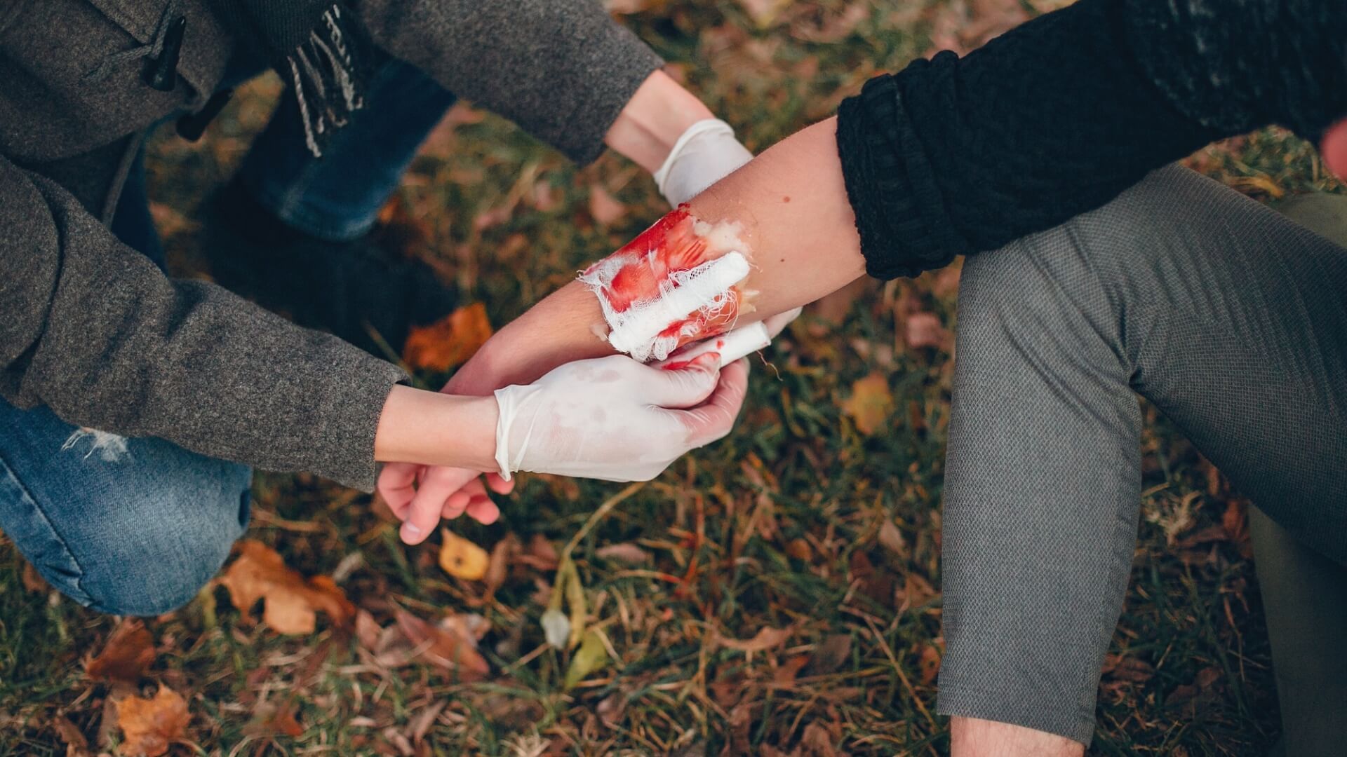 Step-by-Step Guide How to Treat Burn Victims with CPR and First Aid | CPR1