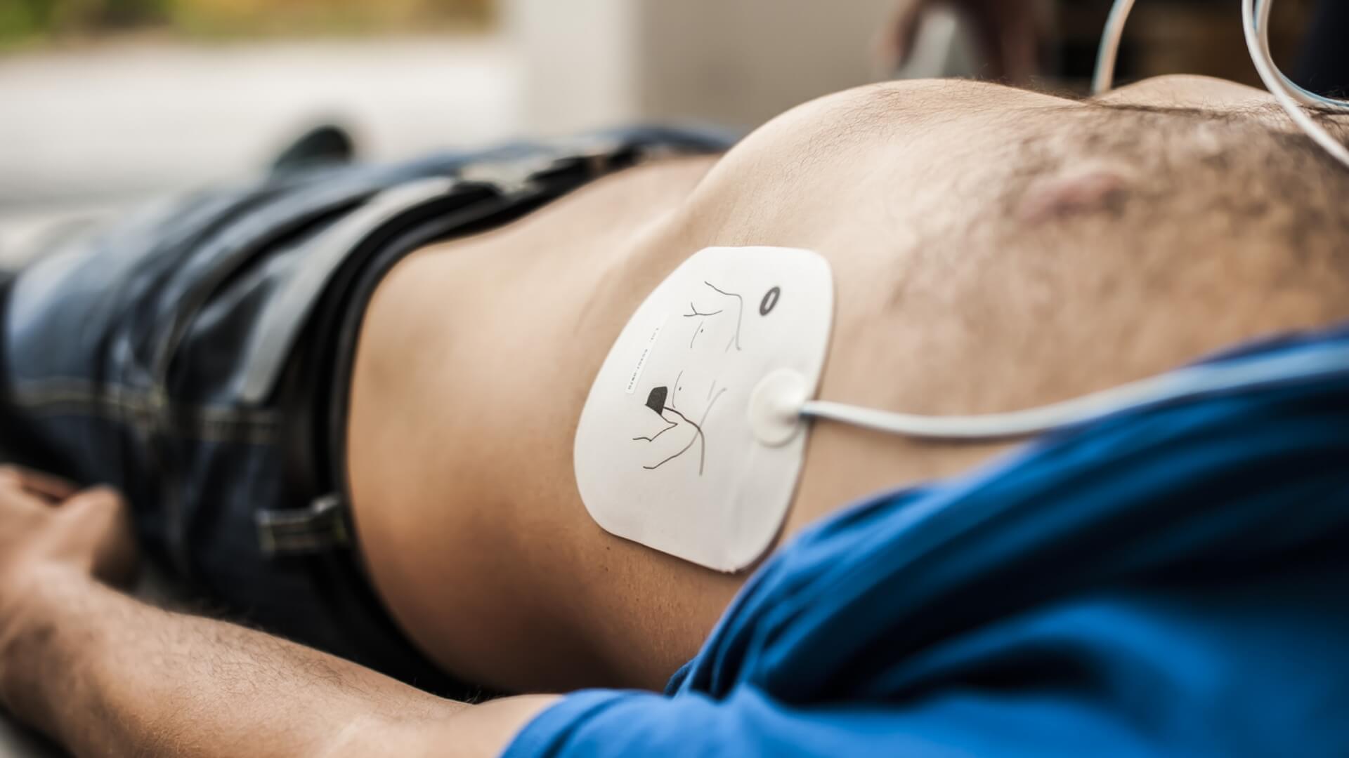 AED Pad Placement Guide Save Lives with Proper Pad Positioning | CPR1