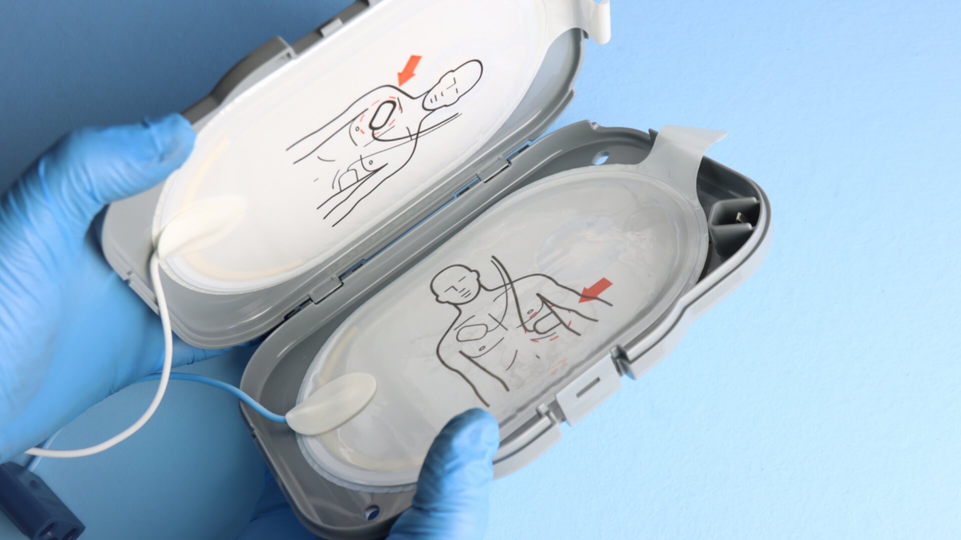 AED Pads Expiration Dates What to Do with Expired Pads and Batteries | CPR1