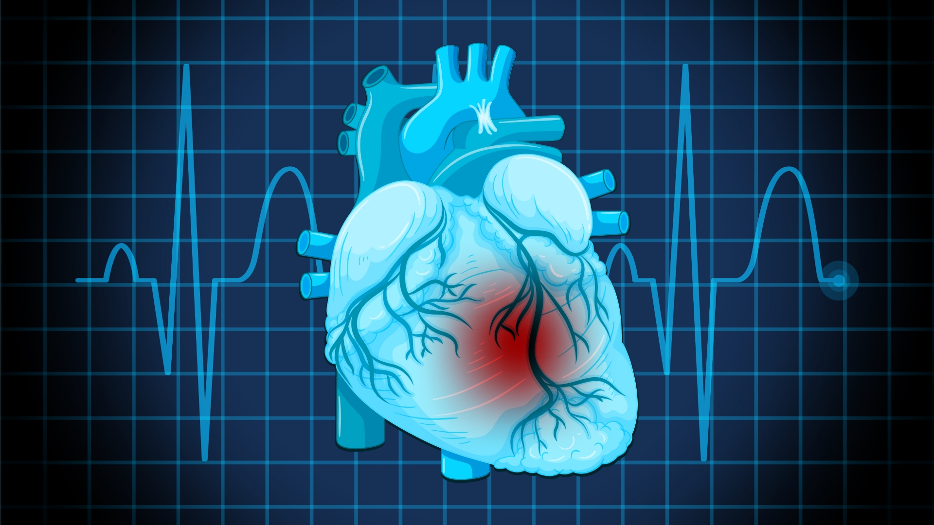 What Are the Shockable Heart Rhythms on an AED CPR1 Guide